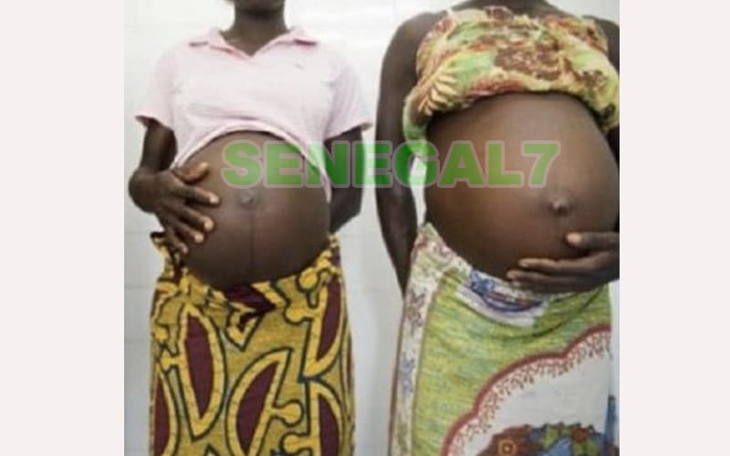 Bigué Ba MBODJI, présidente de l'ANSFES: "Des femmes enceintes atteintes du Covid font des avortements ou sont césarisées..."