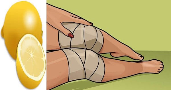Voici comment utiliser le citron pour se débarrasser de la douleur au genou… Une fine Recette de Grand-Mère !