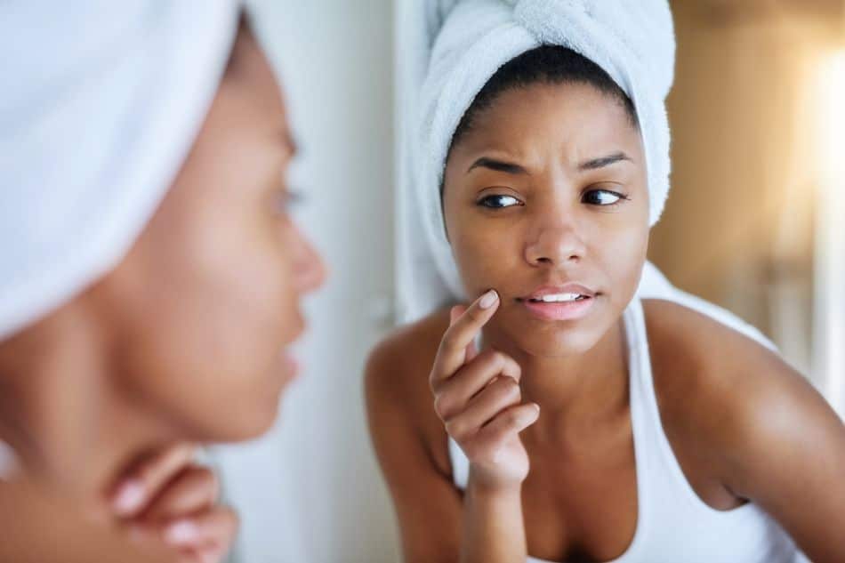 6 conseils pour régler les problèmes de peau grasse du visage