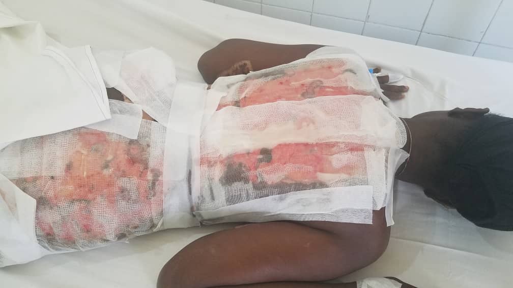 [SOS] Aïssa Fall, victime de brûlure : « Mon cœur peut lâcher à tout moment »