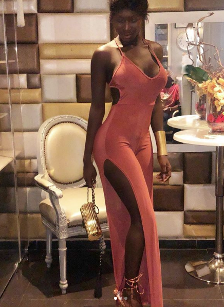 (Photos) Ebene Diop s'affiche après sa chirurgie esthétique