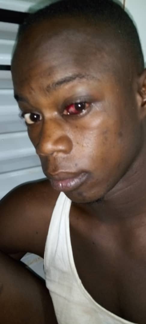 Couvre-feu à Bambey: Yousssoupha Diouf molesté par les policiers, sa famille porte plainte