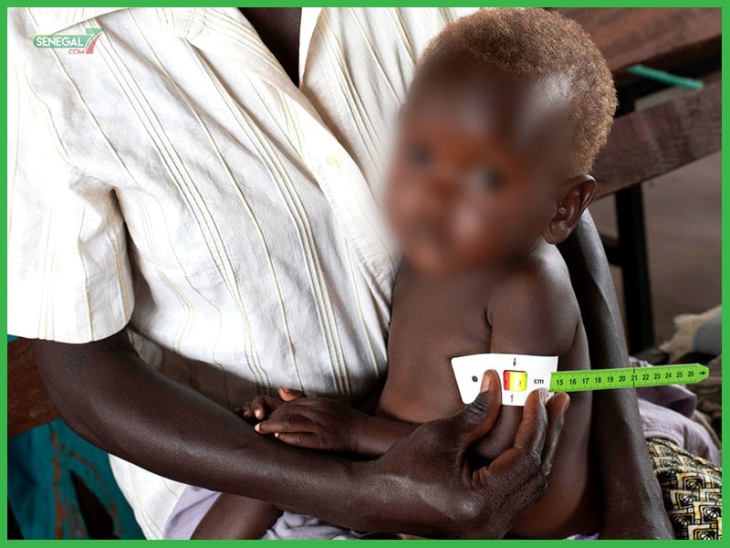 Covid-19: 6,7 millions d’enfants menacés de faim par la pandémie