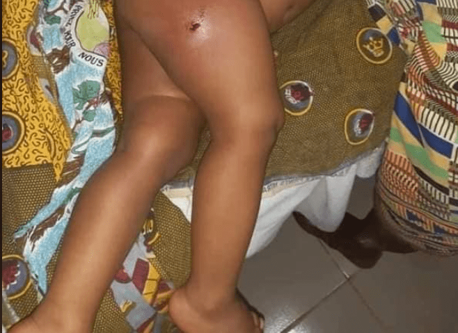 Crise postélectorale en Guinée: un bébé de 14 mois aurait été touché par balle, un autre de 3 ans tué (Photos)