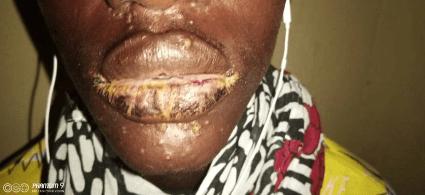 (Photos) Une étrange maladie touche des pêcheurs sénégalais, Thiaroye Sur-Mer troublée