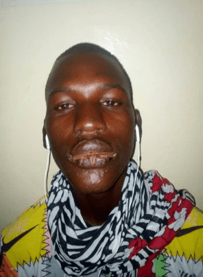 (Photos) Une étrange maladie touche des pêcheurs sénégalais, Thiaroye Sur-Mer troublée