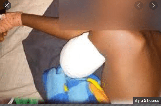 Manifestations de soutien à Ousmane Sonko : l'élève amputé du bras est sorti de l'hôpital