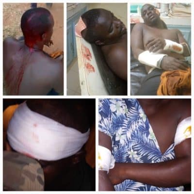 Némékou Tour à Diass : Des affrontements font plusieurs blessés dans le village de Tchiky