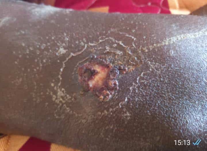 Maroc : Cri de détresse de migrants Sénégalais bloqués, les infections cutanées font rage (Photos + vidéos)