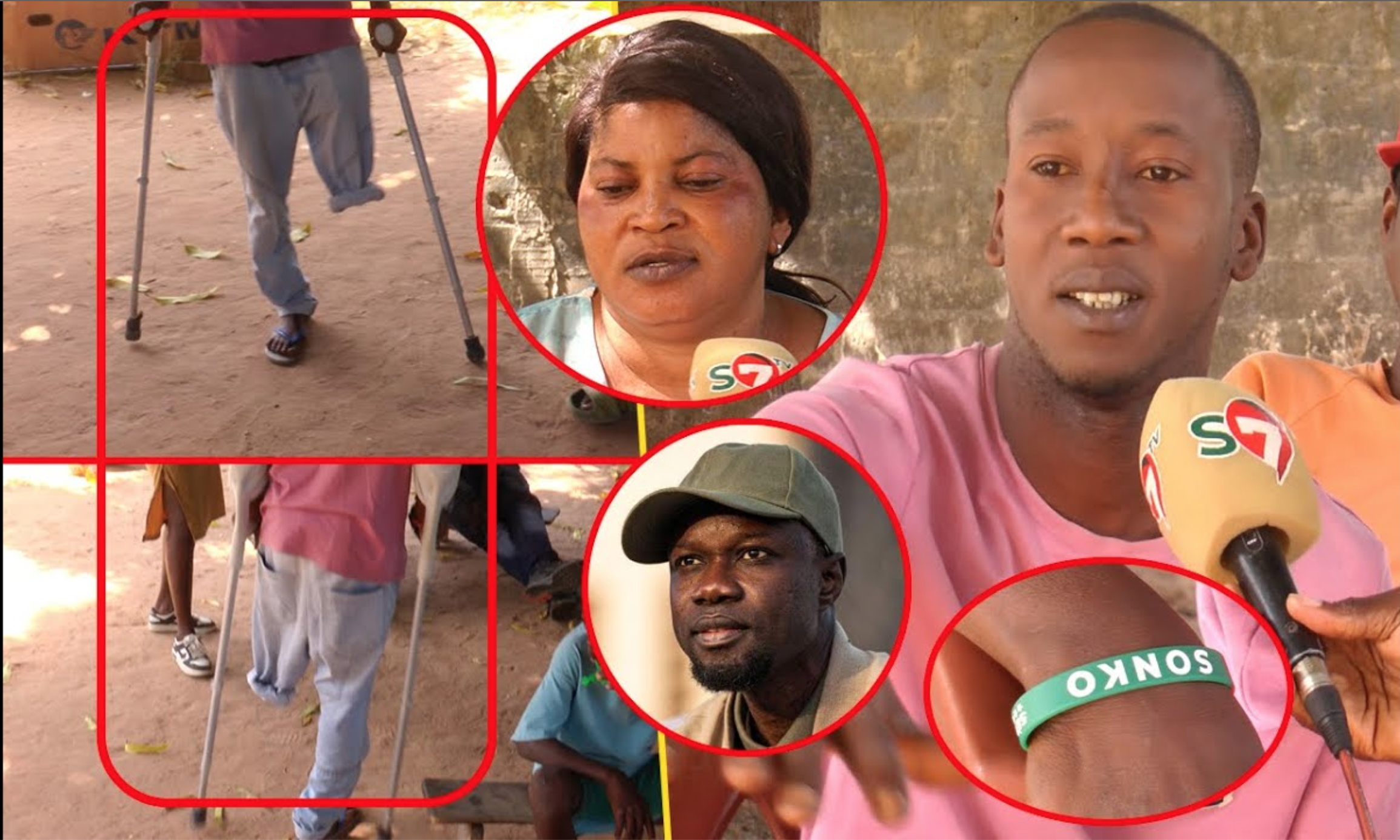 (Vidéo) @mputé d’une jambe lors des m@nifs à Ziguinchor: Boubacar Diallo « Sou amaté Souba ma démate »
