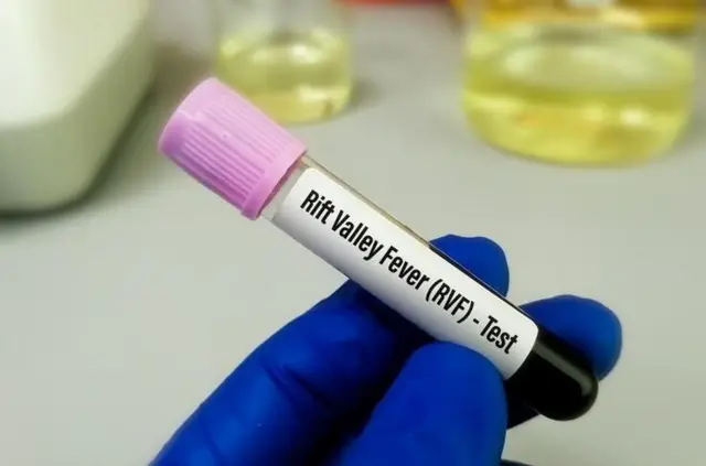 Fièvre de la Vallée du Rift : deux cas confirmés dont un décès à Dahra Djoloff (médecin-chef)