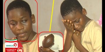 Vidéo | Les souffrances de Habib Diallo (13 ans) qui a perdu la vue : Le triste appel à l’aide de sa famille