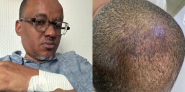 Altercation avec un ASP au tribunal Pikine-Guédiawaye : Oumar Osys Sow grièvement blessé…